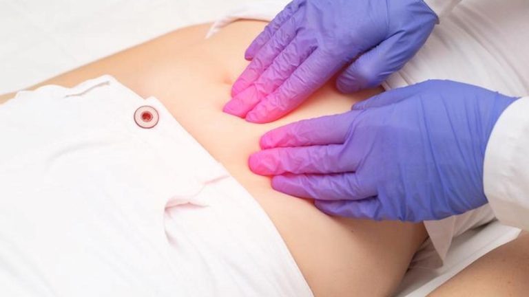 Çikolata kisti belirtileri nelerdir? Çikolata kistini nasıl anlarım? Tedavi yöntemleri nelerdir?