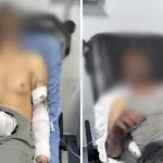 Manisa’da oto tamirhanesinde patlama: 2 kişi ölümden döndü