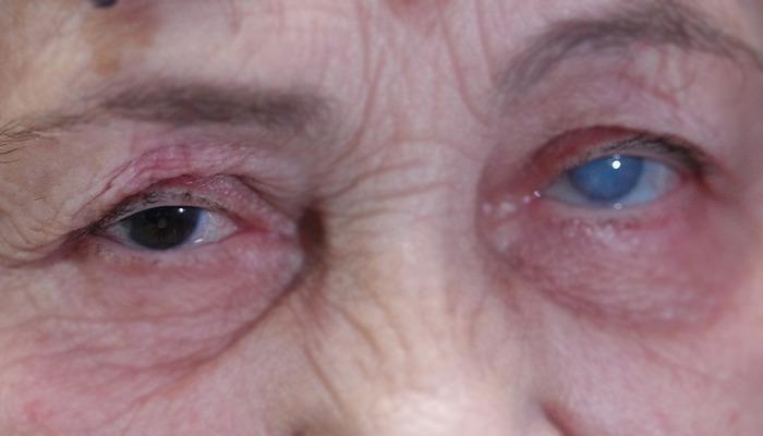 Sisler içinden aydınlığa kavuştu! Resmen ikinci kez hayata gözlerini açtı…