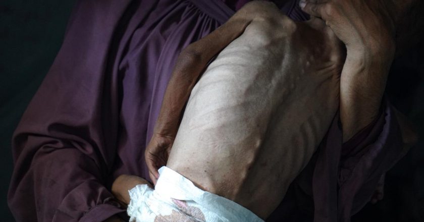 Katil İsrail’in kıtlığı dayattığı Gazze’de son 24 saatte 5 kişi daha açlıktan hayatını kaybetti